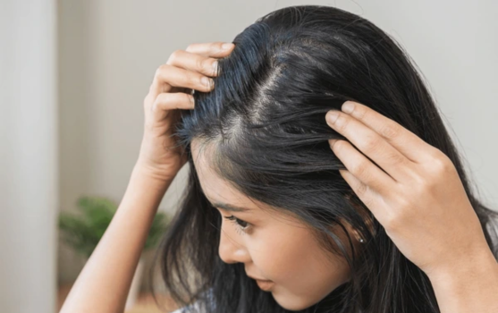 Hair Fall & Damage Repair Solutions Hair Salon HSR Layout Bangalore